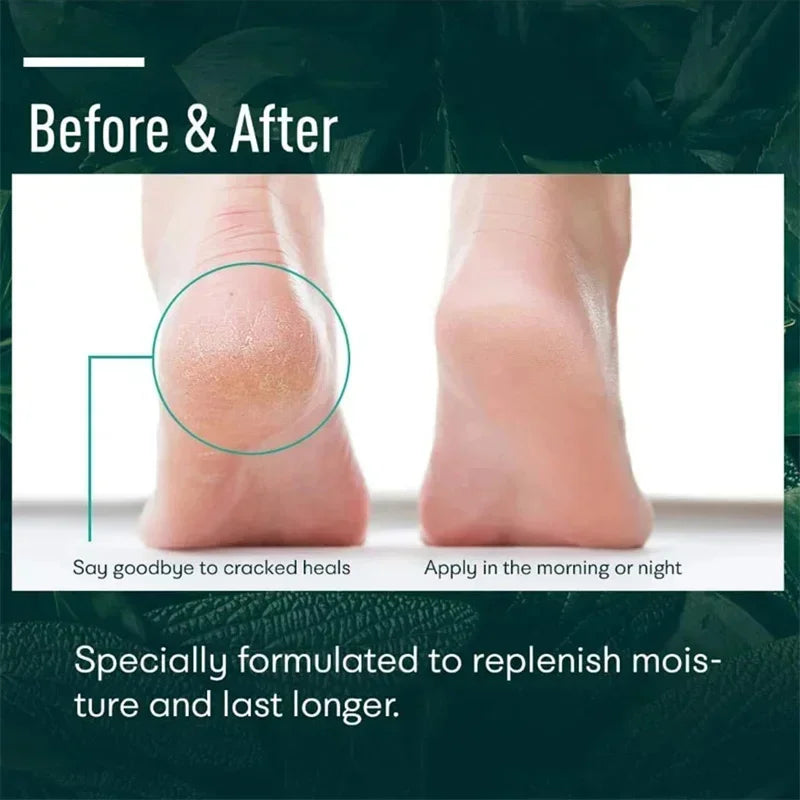 Herbal Anti Crack Foot Cream