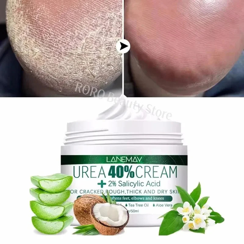 Herbal Anti Crack Foot Cream