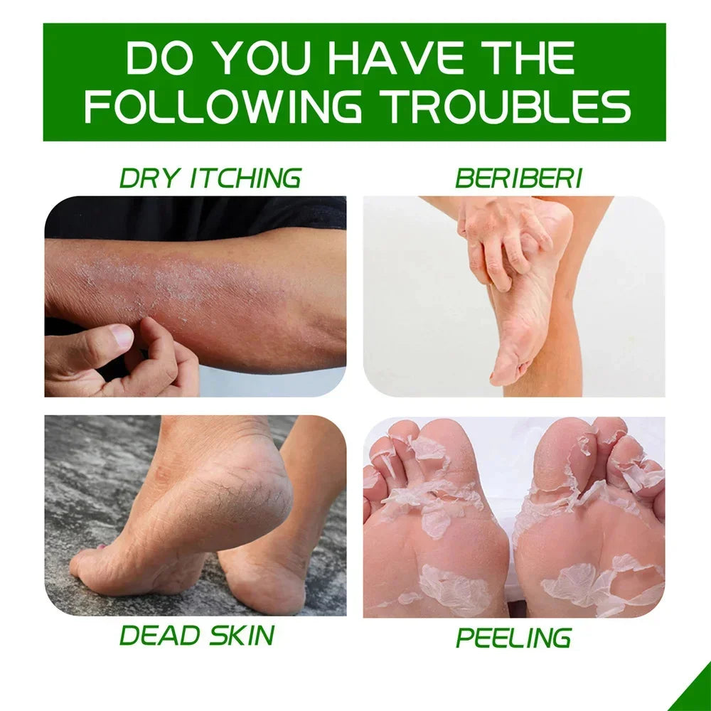 Herbal Anti Crack Foot Cream